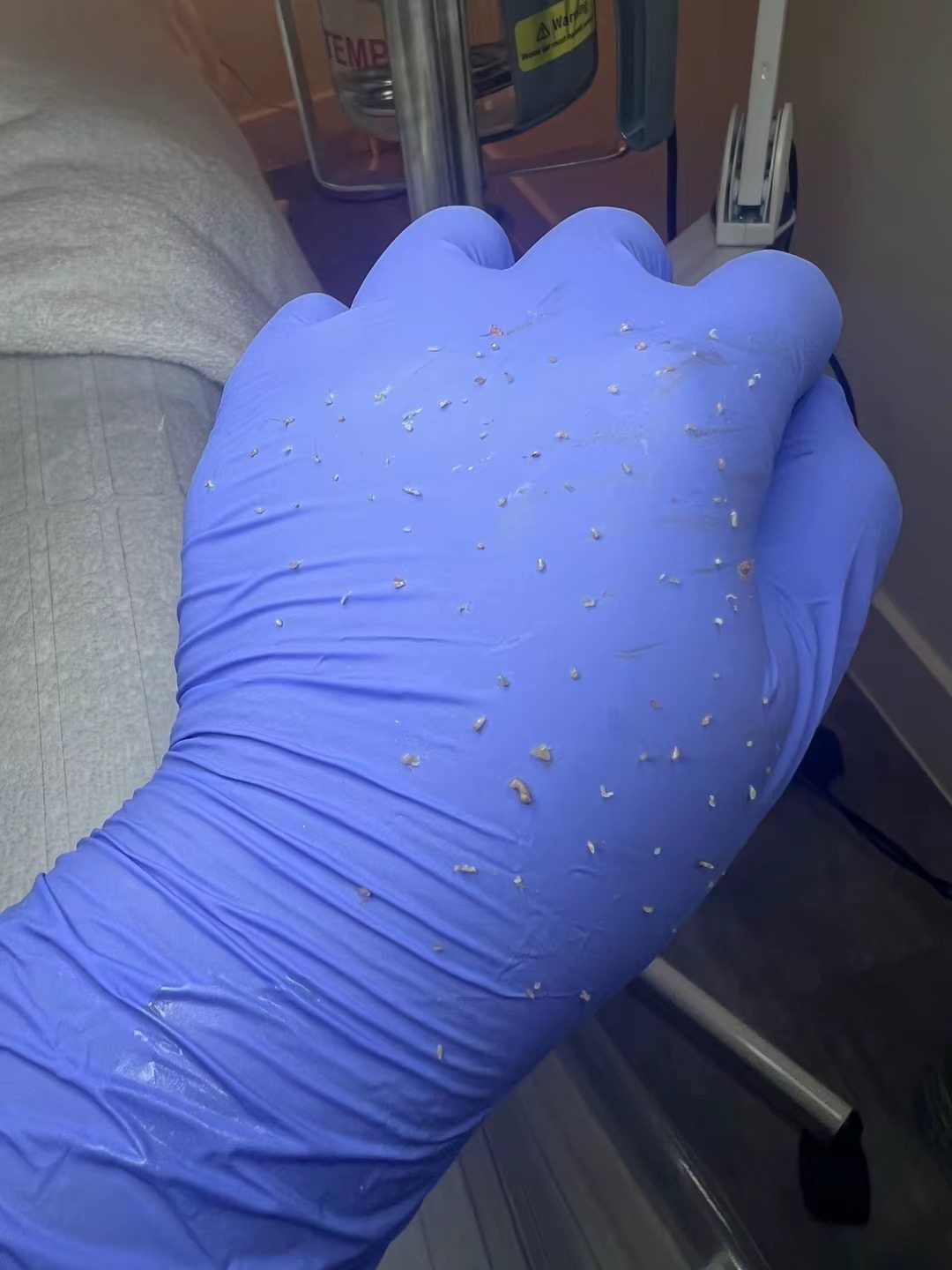 Acne Extraction Care